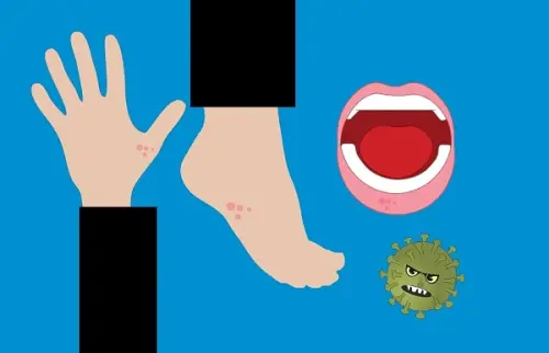 In preoccupante aumento il morbillo nel mondo