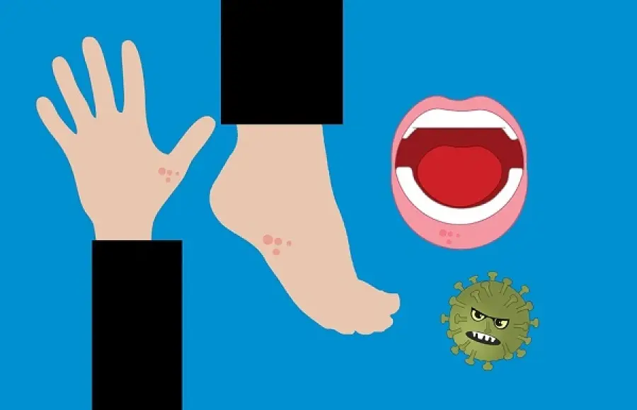 In preoccupante aumento il morbillo nel mondo